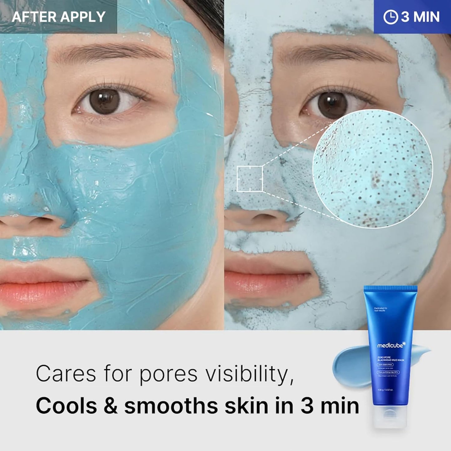 medicube Zero Pore Blackhead