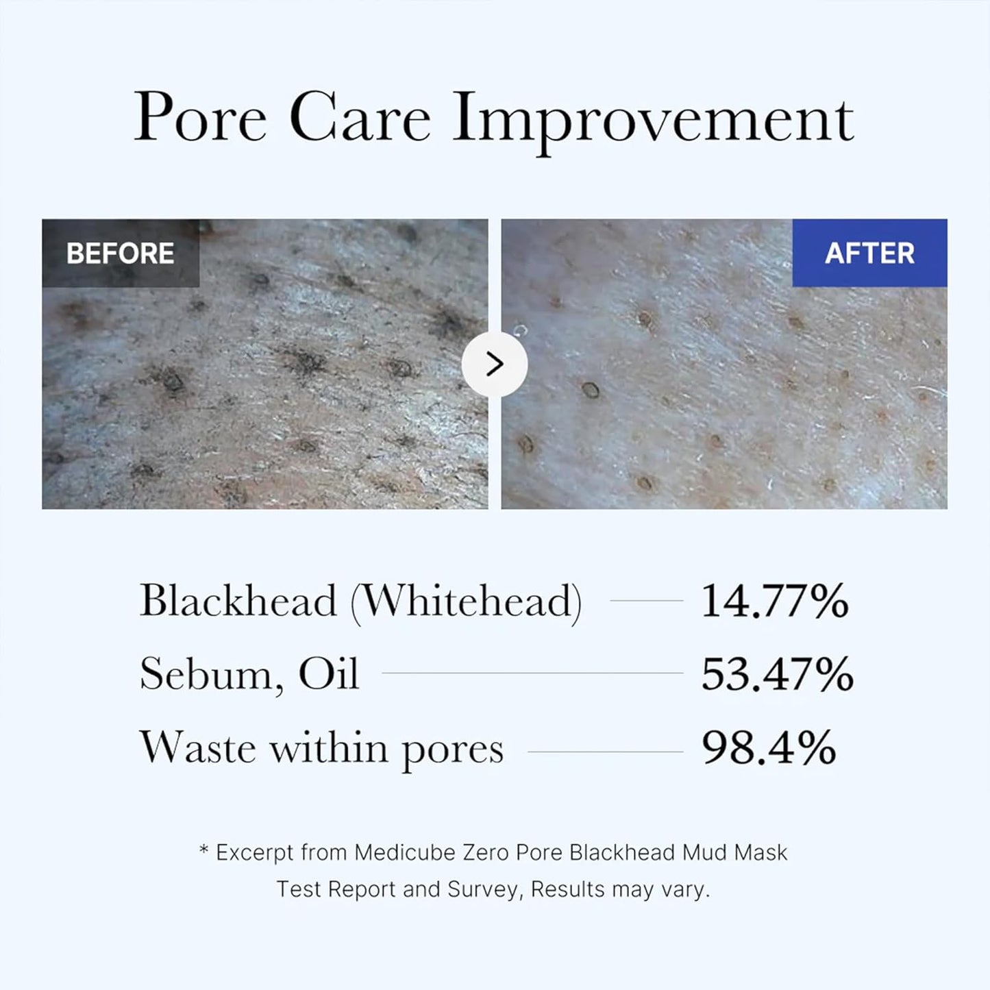 medicube Zero Pore Blackhead